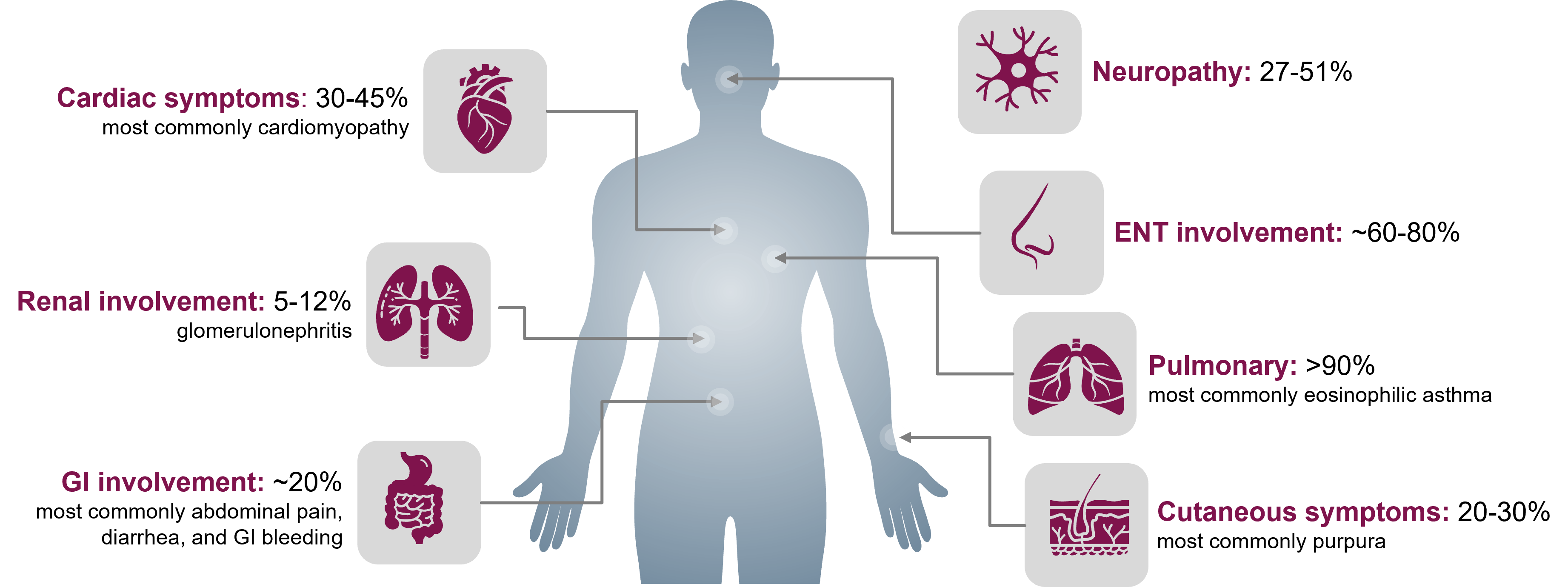 A silhouette with arrows pointing to different parts of the body where EGPA signs and symptoms are prevalent. Neuropathy occurs in 27-51% of patients, ENT involvement occurs in approximately 60-80% of patients, pulmonary signs (most commonly eosinophilic asthma) occurs in over 90% of patients, cutaneous symptoms (most commonly purpura) occur in 20-30% of patients, cardiac symptoms (most commonly cardiomyopathy) occurs in 30-45% of patients, renal involvement (most commonly glomerulonephritis) occurs in 5-12% of patients, and GI involvement (most commonly abdominal pain, diarrhea, and GI bleeding) occurs in approximately 20% of patients.