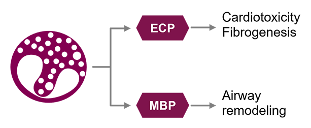 An eosinophil producing eosinophil cationic protein and major basic protein. ECP is associated with cardiotoxicity and fibrogenesis. MBP is associated with airway remodeling.